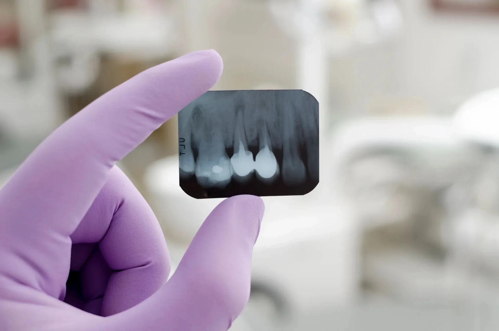 A person holding an x-ray of teeth