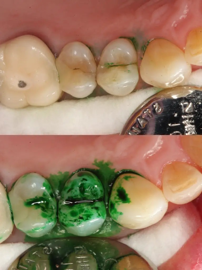 Before and after photos of dental assessment.