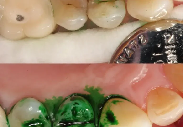 Before and after photos of dental assessment.